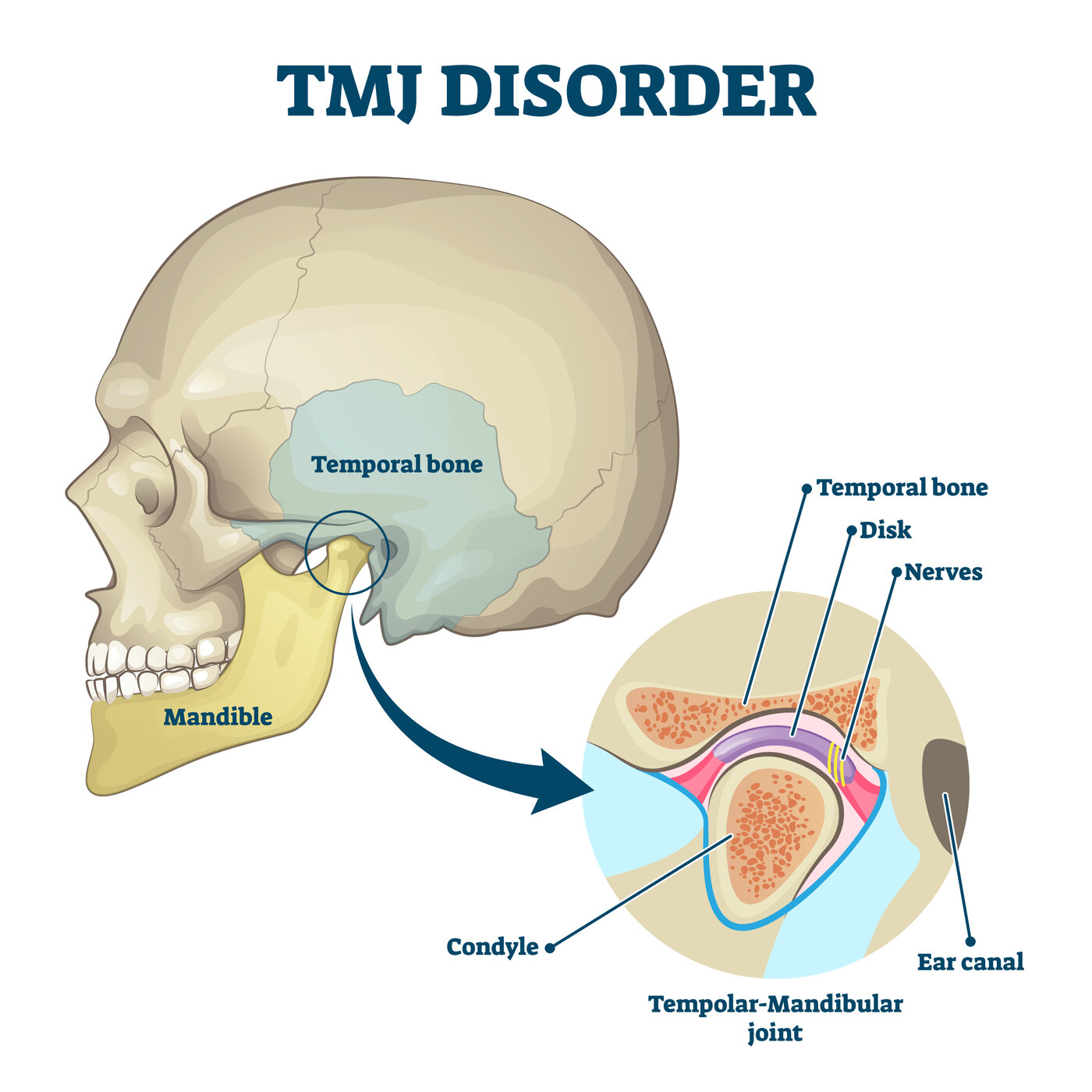 TMJ / Jaw Pain anatomy diagram