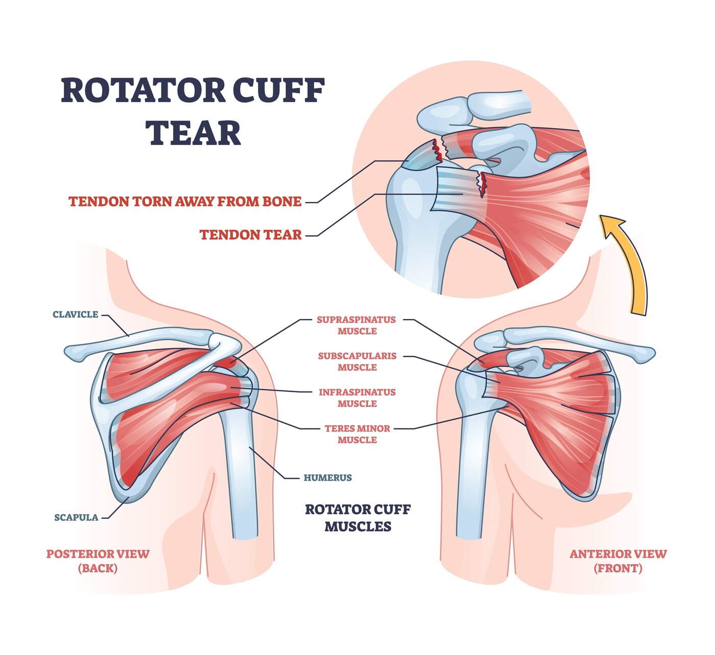 Rotator Cuff Pain & Tendinopathy anatomy diagram